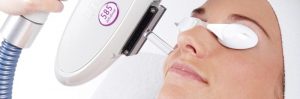laser-and-ipl-skin-treatments1